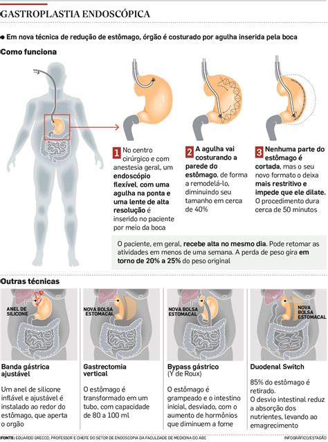 Normal Sentir Dor No Est Mago Depois Da Endoscopia