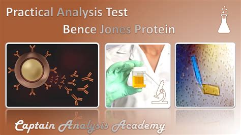 E Bence Jones Protein