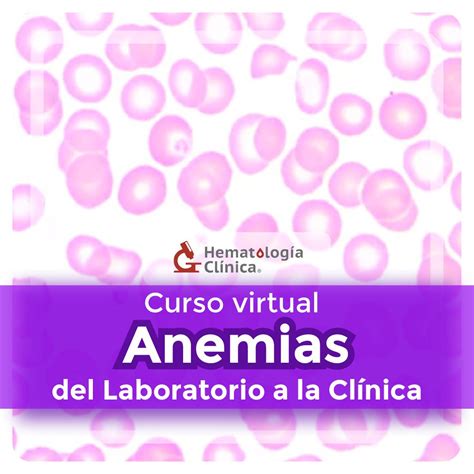 Anemias del laboratorio a la clínica Junio 2024 Hematología