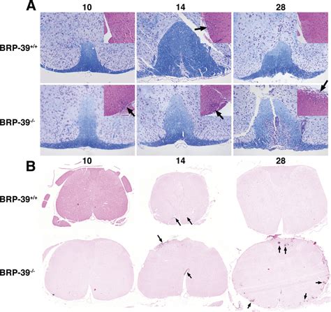 Increased Inflammation In Brp 39 Jj Mice During Eae A Luxol Fast