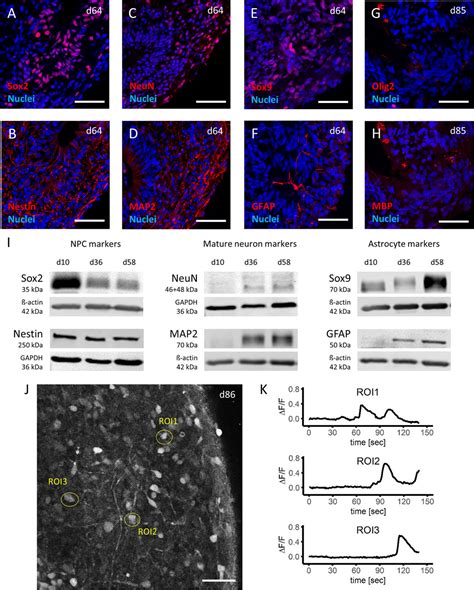 Frontiers Induced Pluripotent Stem Cell Derived Brain Organoids As