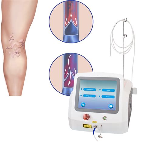 Evlt Surgical Laser Varicose Vein Treatment Evlt Laser Machine