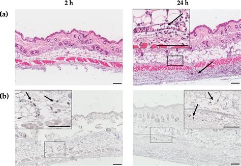 Figure From Refining Immunogenicity Through Intradermal Delivery Of