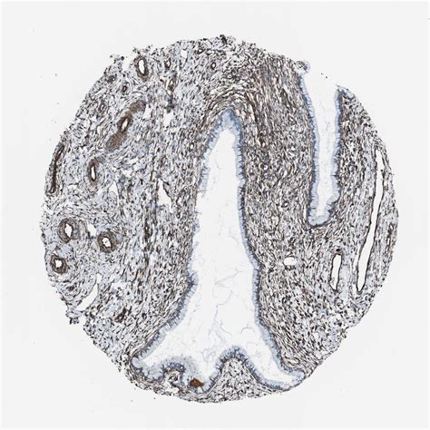 Tissue Expression Of Zdhhc6 Staining In Cervix The Human Protein Atlas