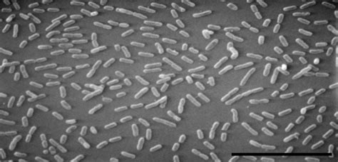 Bordetella bronchiseptica | Mechanisms of Pathogenicity