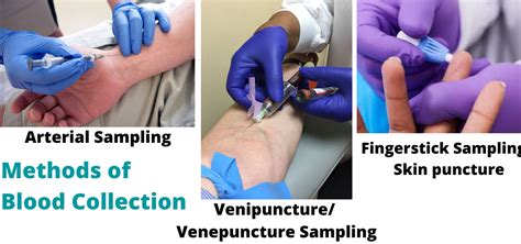 Blood Collection Methods; Arterial , Venipuncture, Fingerstick Sampling