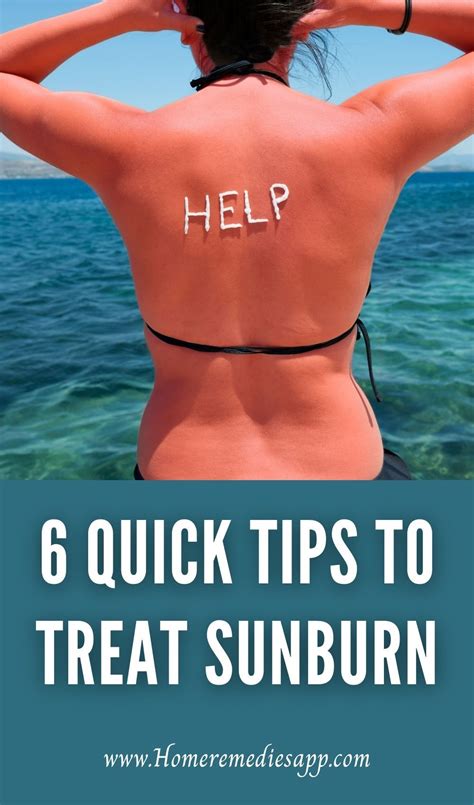 10 Easy And Natural Ways To Soothe Sunburn Fast Artofit