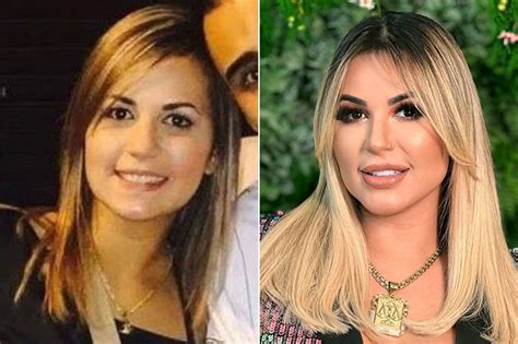 Antes E Depois Vejam Como Eram Essas Celebridades Antes Dos