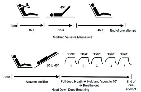 Svt Adenosine And Postural Modification To The Valsalva 43 Off