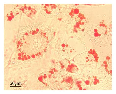 Oil Red O Staining In Undifferentiated 3t3 L1 Cells A And After 5