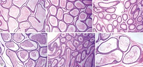 Photomicrograph Of Rat Epididymis Stained With He X 160 Caput And