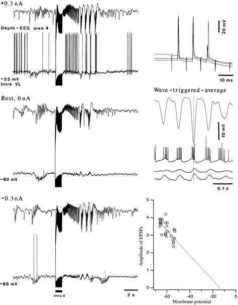 Spike Wave Complexes And Fast Components Of Cortically Generated Seizures Iv Paroxysmal Fast