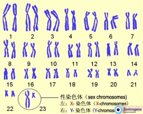 孕妈必看:无创DNA检查23对染色体异常对应疾病有哪些?_综合症