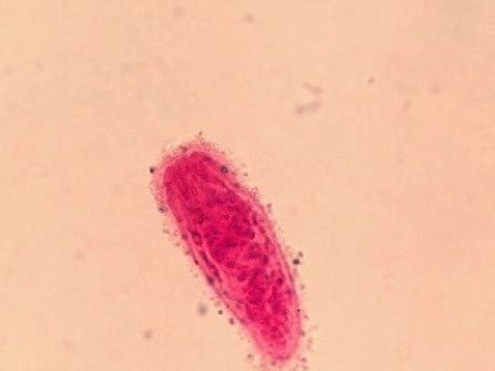 Microbiology Lab Practical Flashcards Quizlet