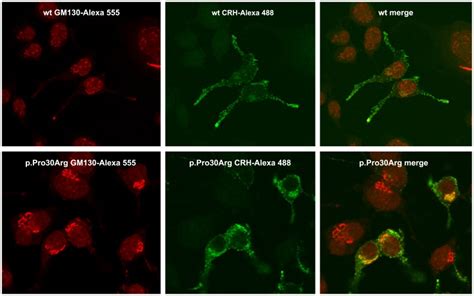 To Investigate Intracellular Distribution Of CRH Cell Were Fixed In