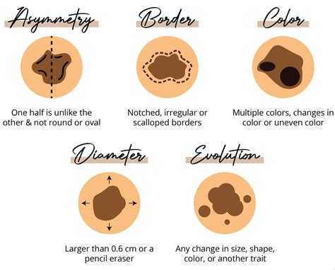 Melanoma Awareness Month: Essential Skin Checks and Prevention Tips ...