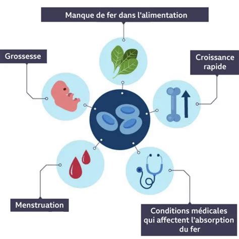 Carence En Fer Quels Sont Les Signes Les Plus Courants BBC News