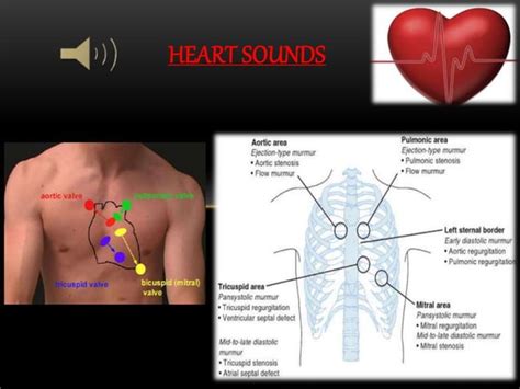 Heart Sounds And Murmurs PPT