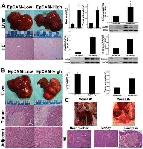 Hep3b And Hepg2 Evaluation In Orthotopic Athymic Nuj Mouse Models