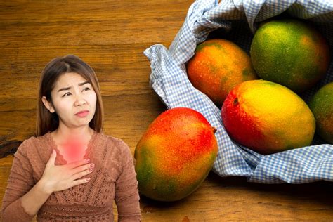 Quem Tem Refluxo Pode Comer Manga Descubra Se A Fruta Bem Tolerada