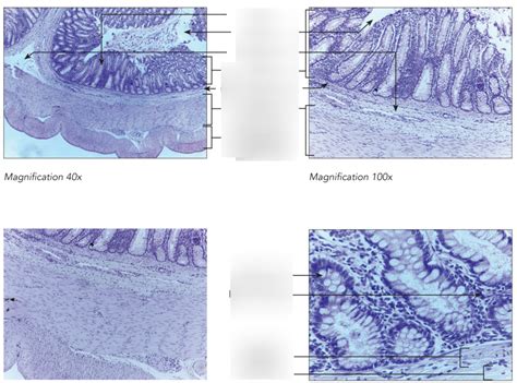 LARGE INTESTINE HISTOLOGY Diagram Quizlet