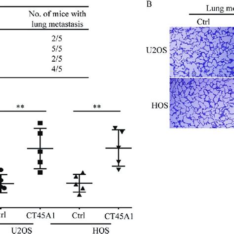 Ct A Promotes The Metastasis Of Osteosarcoma Cells In Vivo A The