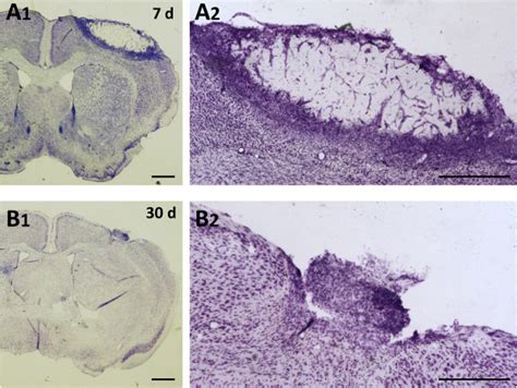 Representative Temporal Evolution Of Photothrombotic Damage Coronal