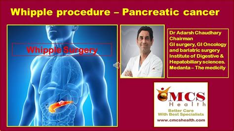 Whipple Procedure Pancreatic Cancer In India Cmcs Health Youtube