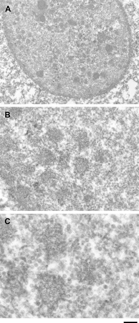 Clusters of JC virus progeny virions observed by electron microscopy ...