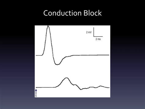 ncs study - basics of nerve conduction study | PPTX
