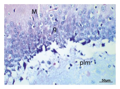 Photomicrographs of sections in the hippocampus of male rats. (a, b ... 