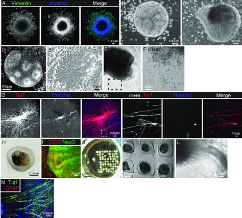 Induction Of Brain Organoids From IPSCs On GelMA Hydrogel With