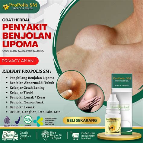 Jual Cod Obat Untuk Benjolan Lipoma Kelenjar Getah Bening Tiroid