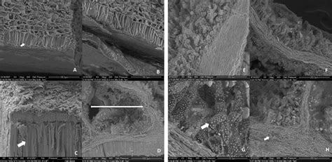 Scanning Electron Micrographs Of The Shell Of Cashew Nut A