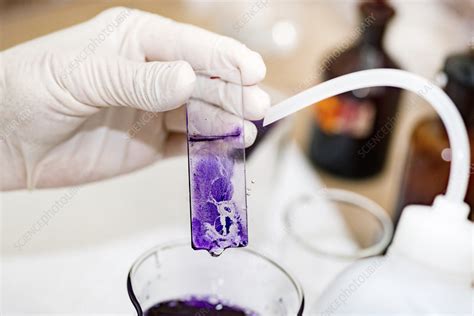 Staining microscope slide - Stock Image - F024/5617 - Science Photo Library