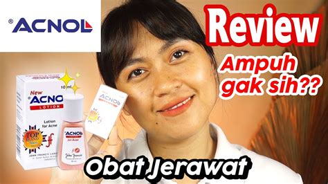 Review Acnol Lotion Obat Jerawat Risa Florendo Youtube