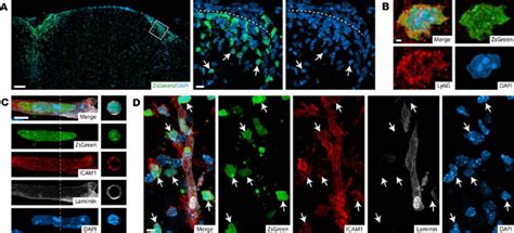 Icam And Icam Neutrophils Are Differently Distributed In The Spinal