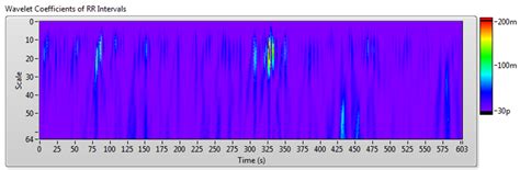 Archived Using Labview For Heart Rate Variability Analysis Ni