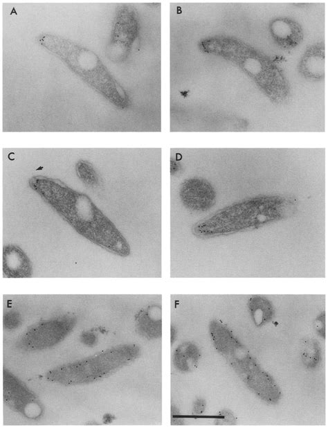 Localization Of Mcpa Fusion Proteins Within C Crescentus Swarmer Cells