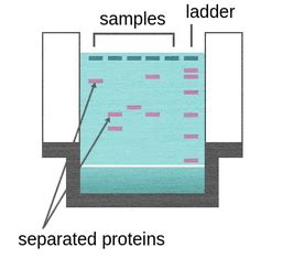 Protein gel electrophoresis - Labster