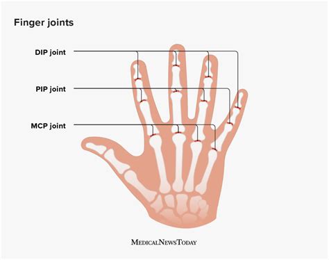 Distal interphalangeal joint (DIP): Pain, symptoms, and more