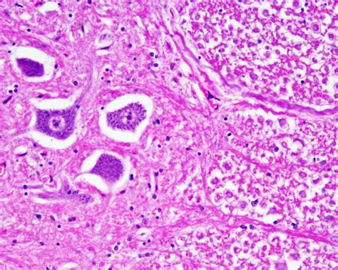 Spinal Cord Cross Section Histology Labeled