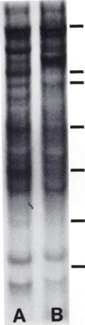 Autoradiogram Of L Labeted Cell Surface Proteins From Hct Cells