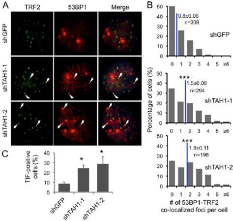 TAH1 Regulates Telomere DNA Damage Responses In ALT Cells A