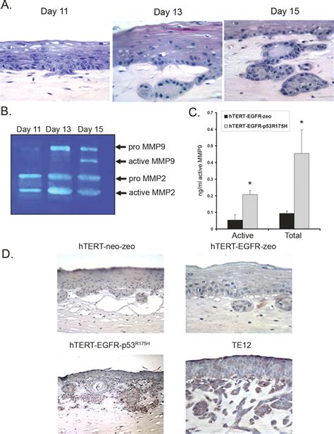 The Functional Interplay Between EGFR Overexpression HTERT Activation