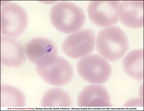 Plasmodium Vivax Cell Atlas Of Haematological Cytology