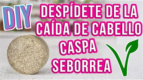 Shampoo S Lido Diy Contra La Caspa Caida De Cabello Y Seborrea