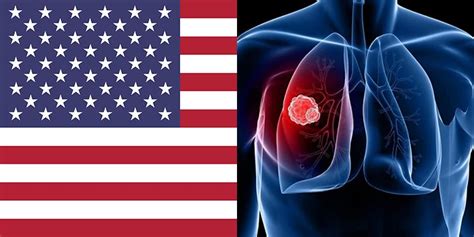 Lung Cancers In United States