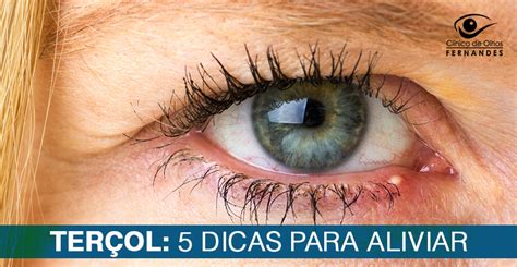 O Que Fazer Terçol No Olho Sobre os Olhos