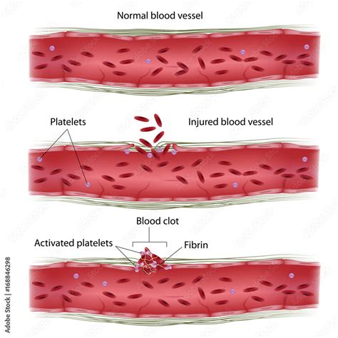 Blood clotting process Stock Illustration | Adobe Stock